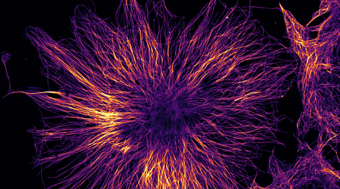 Confocal-present-workshops-Re-scan-Confocal-Microscopy