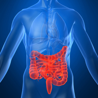 Approximately 600,000 patients die of colorectal cancer each year worldwide.