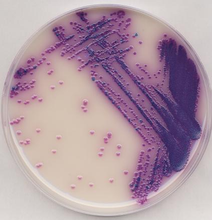 Brilliance Salmonella Agar; the chomogenic plate medium used in the Oxoid Salmonella Precis method