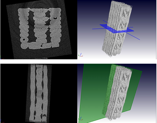 3D CT scans