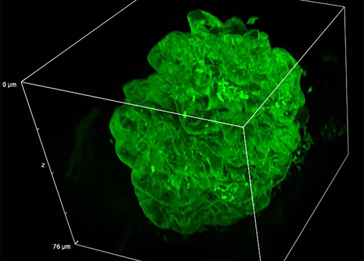 crestoptics-introduces-deepsim-super-resolution