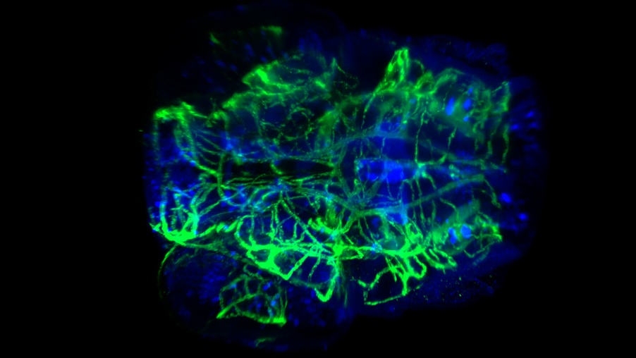 the-speed-lifelight-sheet-microscopy-advances