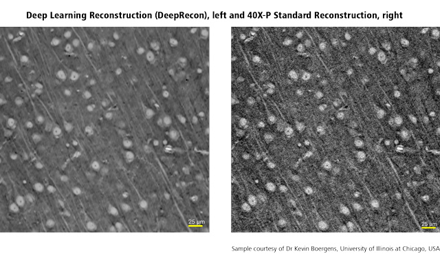 aipowered-xray-microscope-reconstruction-technologies