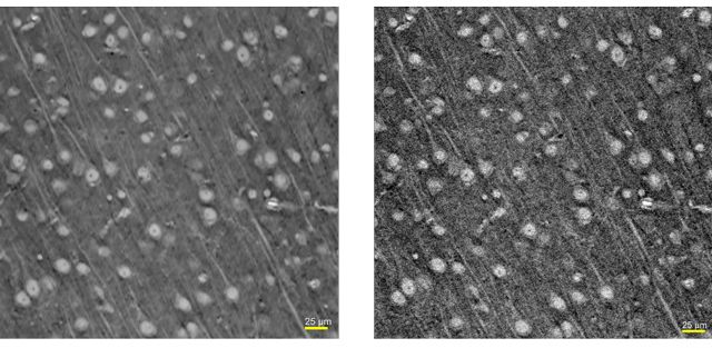 aipowered-xray-microscope-reconstruction-technologies