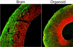 Comparison of the organoid