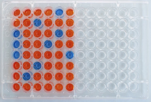 ELISA and Lateral Flow-based assays