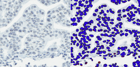 Getting Started with RNAscope™ Image Analysis in HALO® - Indica Labs