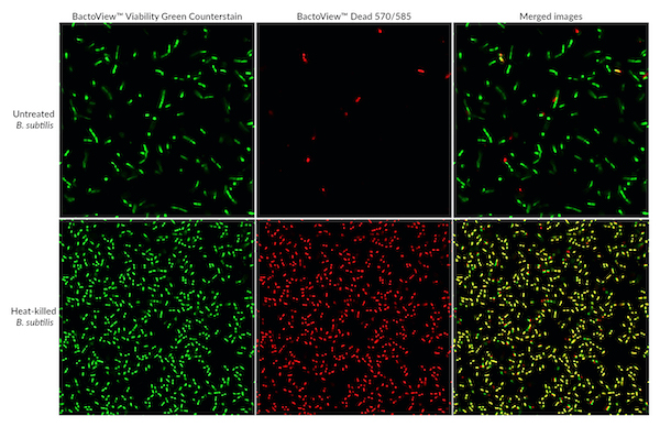 biotium-introduces-new-highlyselective-stains-both