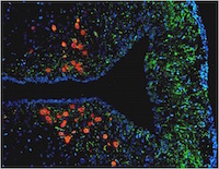 MicroMatrices staining Red