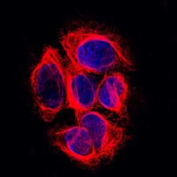 Microtubules in melanoma cells