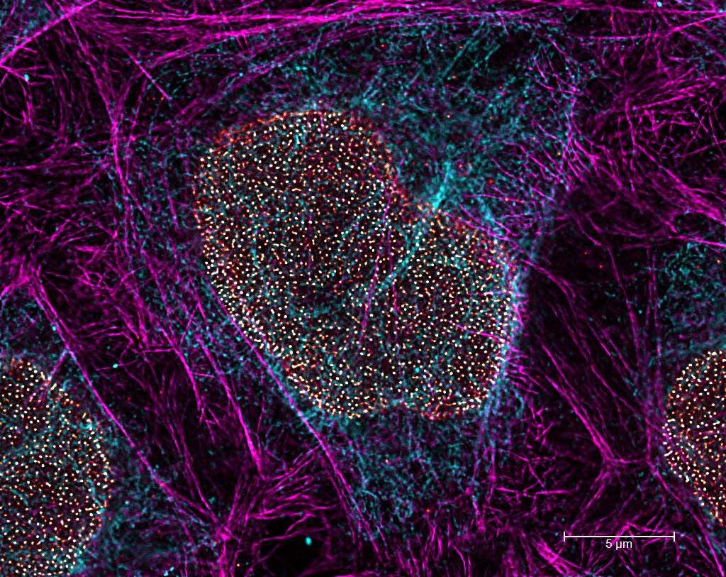 extended-live-cell-imaging-nanoscale-resolution