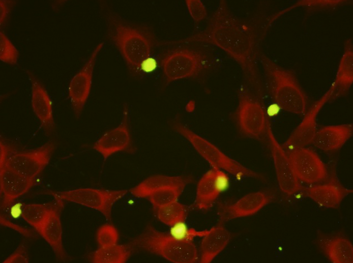 Mycoplasma-pneumoniae