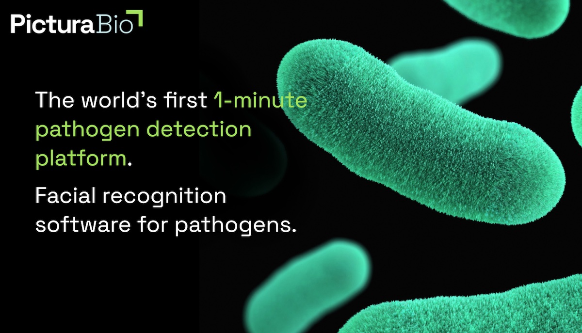 oxford-university-scientists-ai-diagnostic-test