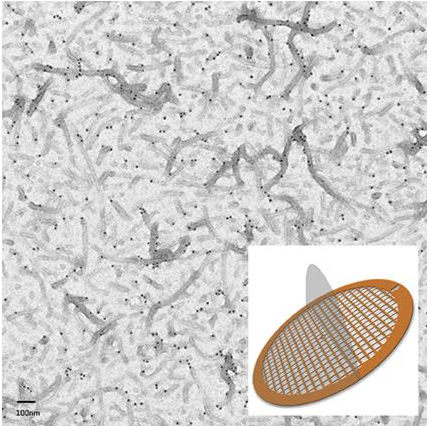 Protein filaments immunogold