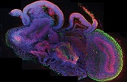 cross-section of an entire organoid