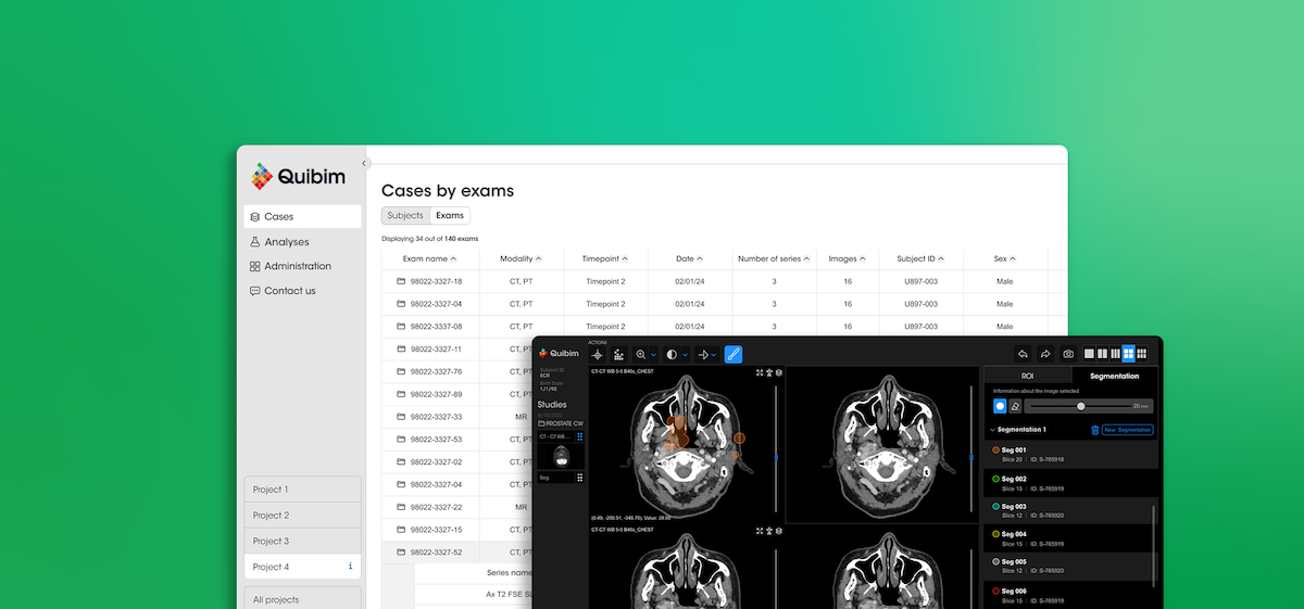 quibim-launches-platform-deploy-imagingbased-algorithms