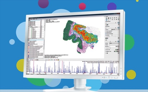 SCiLS Lab Software for MALDI Imaging