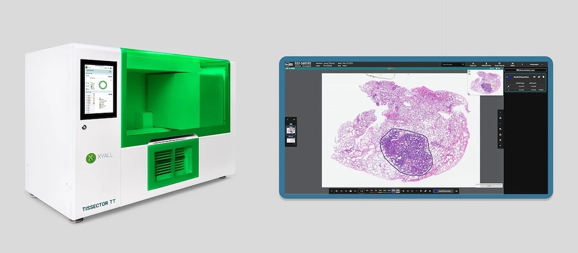 molecular-and-digital-pathology-innovators-xyall-and