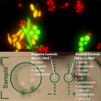 Yeast Species Identification from Positive Blood Culture in just 20 minutes