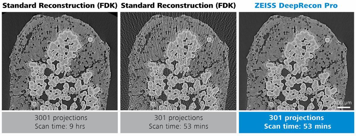 zeiss-applies-artificial-intelligence-3d-xray