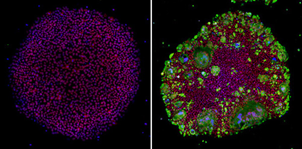 new-ipsc-model-covid19