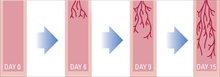 Directed In Vivo Angiogenesis Assessment Assays