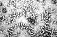 electron-micrograph-reveals-the-presence-of-hepatitis-b-virus