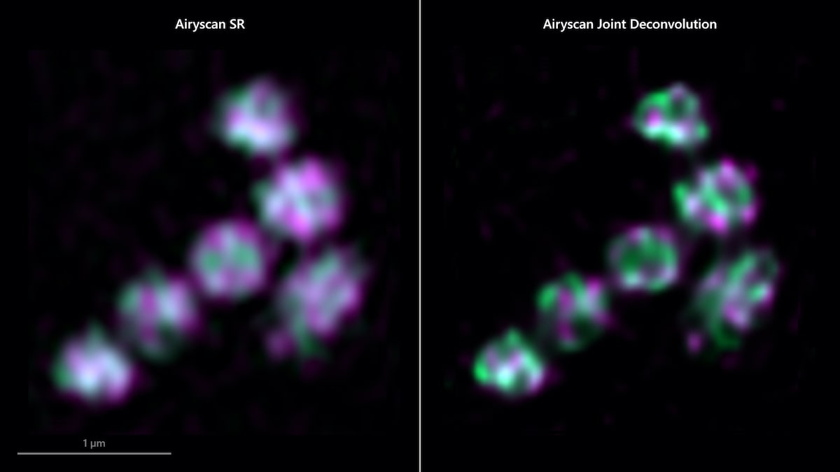 improved-image-quality-and-resolution-all-zeiss-laser