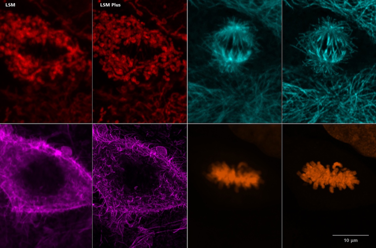 improved-image-quality-and-resolution-all-zeiss-laser