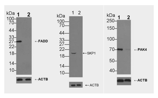 Knockout and Knockdown Validated Antibodies